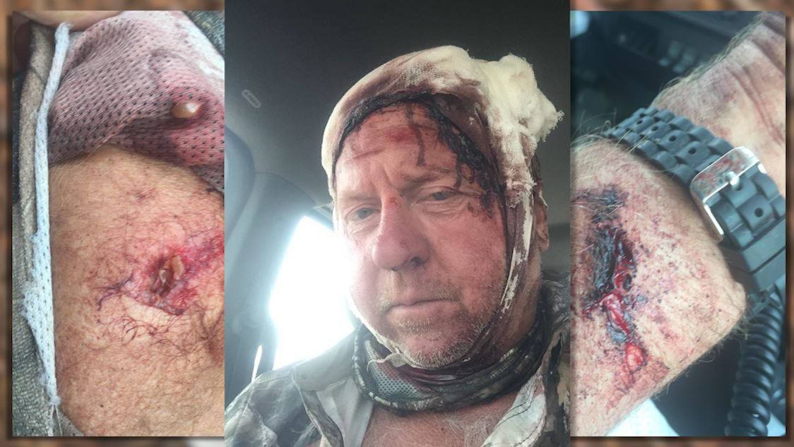 bear attack pictures